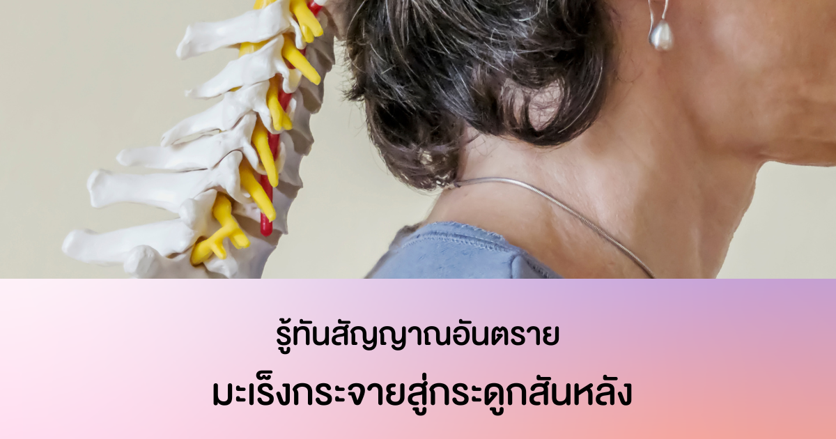 มะเร็งกระจายสู่กระดูกสันหลัง